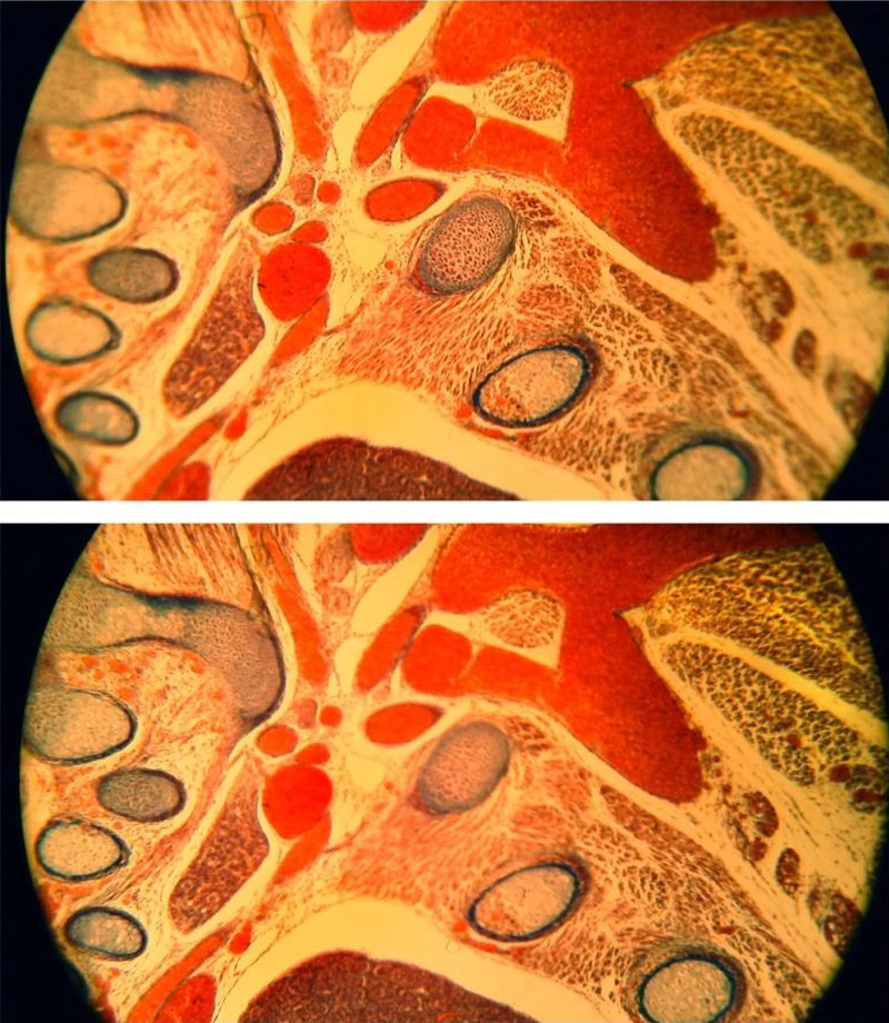 Abb. 12: Demonstration des selektiven Autofokus, histologischer Routineschnitt (Rattenembryo), Hellfeld, ungefiltertes Glühlampenlicht, Kursmikroskop Leitz HM-Lux 3, Fremd-Objektiv Phaco 10/0,25 (einfacher Achromat, Will Wetzlar), Okular Periplan GF 10x/18 (für Brillenträger), massive Randunschärfe, automatische Fokussierung der Bildmitte (oben) und Bildperipherie (unten).