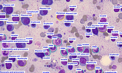 Die Mikroskopie-Kameras von The Imaging Source liefern Bilder für die digitale Pathologie